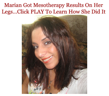 mesotherapy results on legs