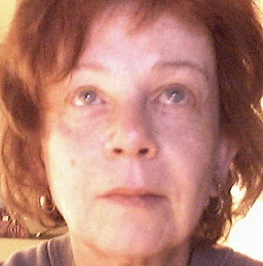 face fat reduced