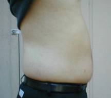 tummy side